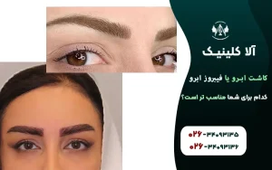 کاشت ابرو یا فیبروز ابرو، کدام برای شما مناسب تر است؟