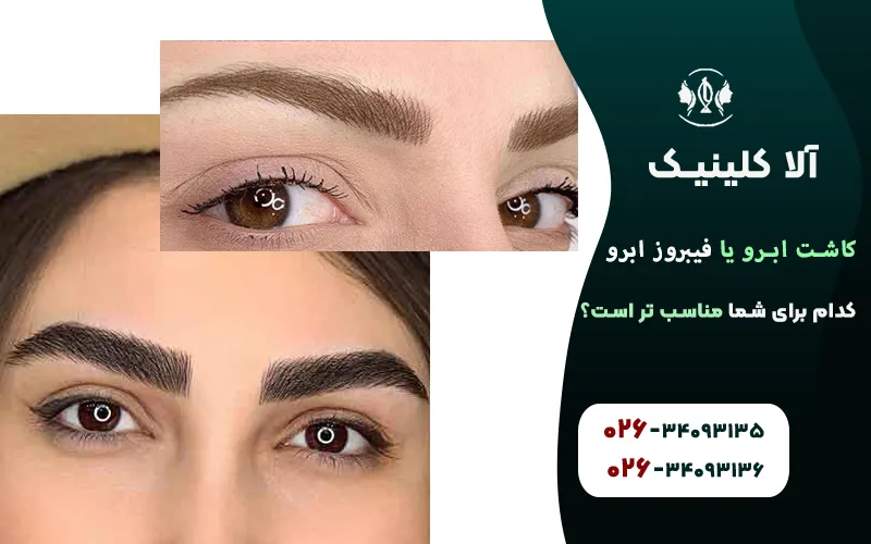 کاشت ابرو یا فیبروز ابرو، کدام برای شما مناسب تر است؟
