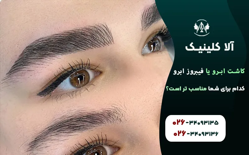 کاشت ابرو یا فیبروز ابرو، کدام برای شما مناسب تر است
