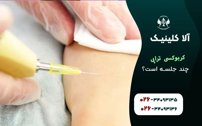 کربوکسی تراپی چند جلسه است