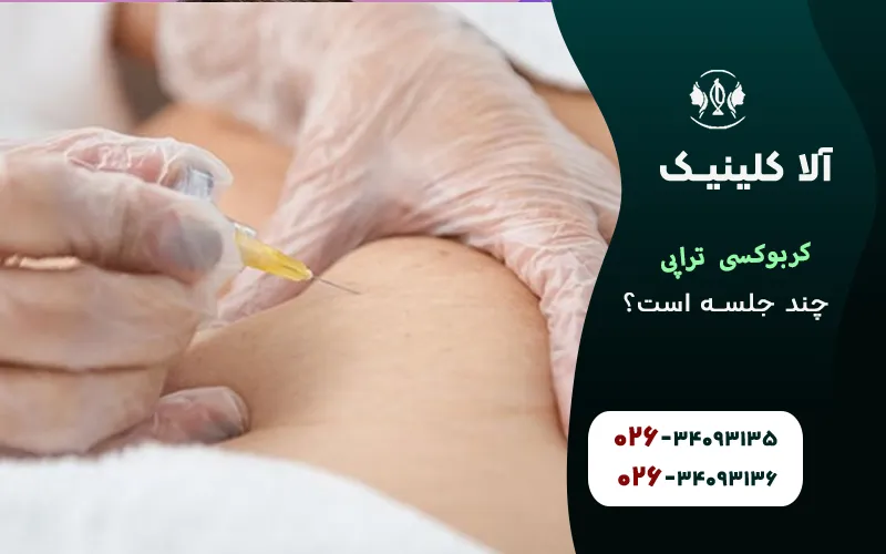 کربوکسی تراپی چند جلسه است