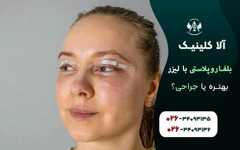 بلفاروپلاستی با لیزر بهتره یا جراحی