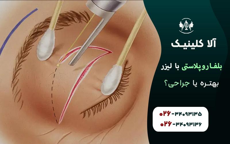 بلفاروپلاستی با لیزر بهتره یا جراحی