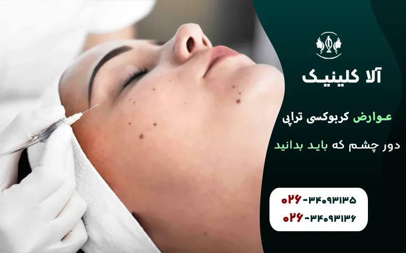 عوارض کربوکسی تراپی دور چشم
