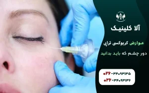 عوارض کربوکسی تراپی دور چشم