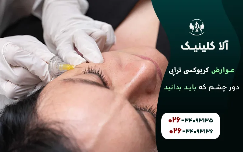 عوارض کربوکسی تراپی دور چشم
