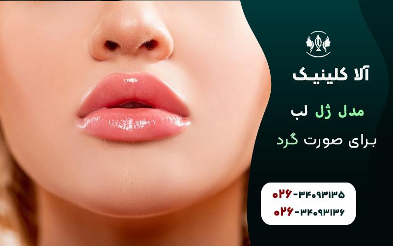 مدل ژل لب برای صورت گرد