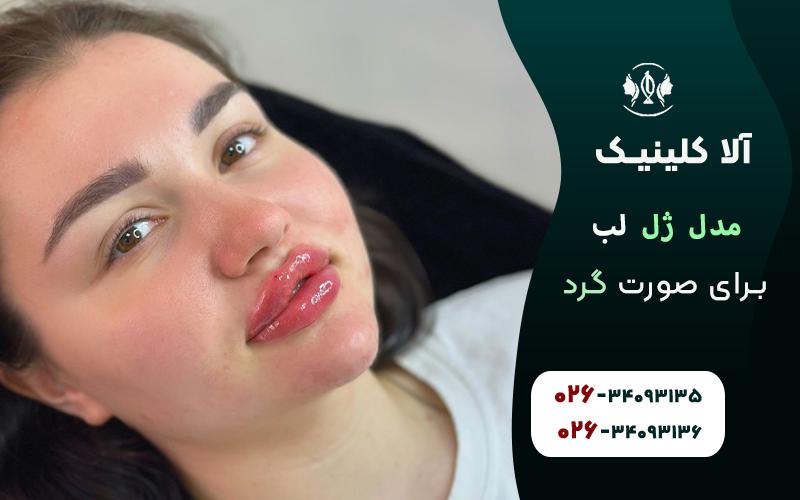 مدل ژل لب برای صورت گرد