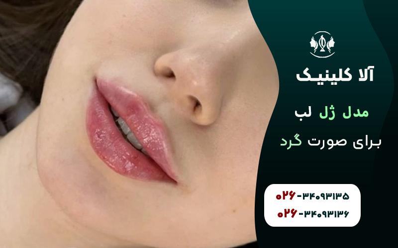 مدل ژل لب برای صورت گرد