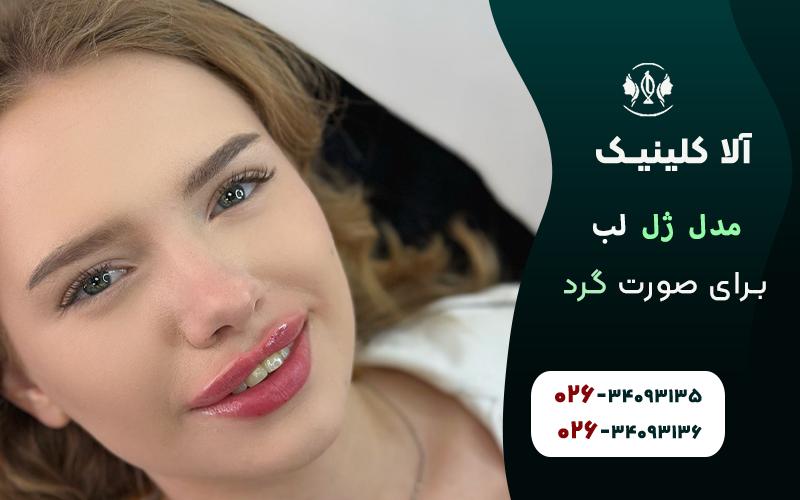 مدل ژل لب برای صورت گرد