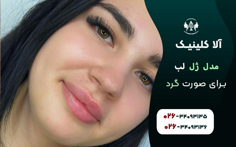 مدل ژل لب برای صورت گرد