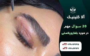 20 سوال مهم در مورد بلفاروپلاستی (جراحی پلک) + پاسخ