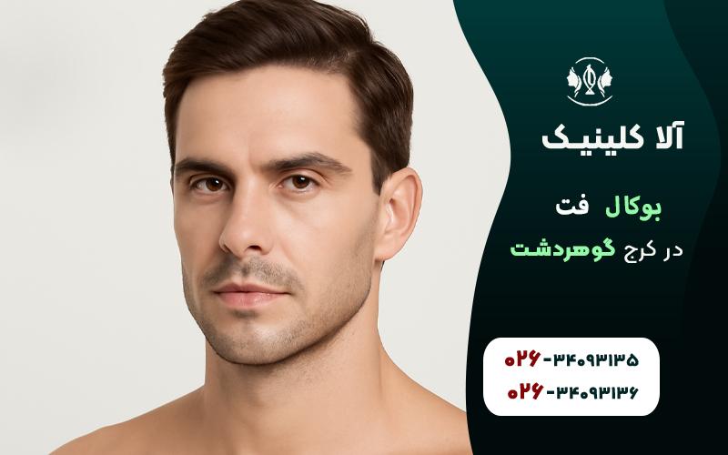 بهترین جراح بوکال فت در کرج