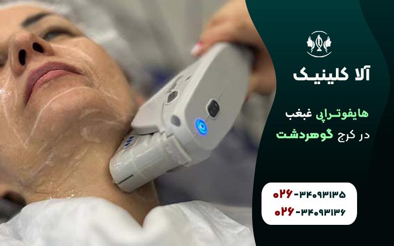 هایفوتراپی غبغب در کرج