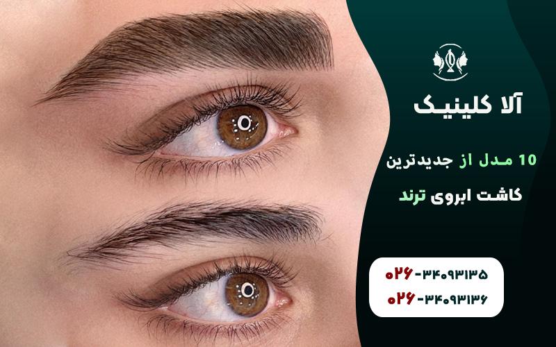 جدیدترین مدل های کاشت ابروی ترند
