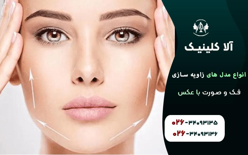 انواع مدل های زاویه سازی فک و صورت