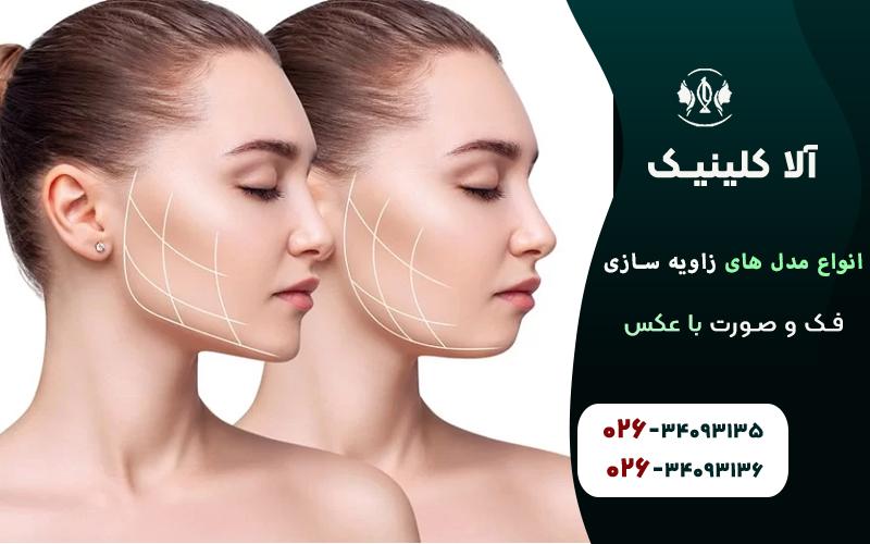 انواع مدل های زاویه سازی فک و صورت با عکس قبل و بعد