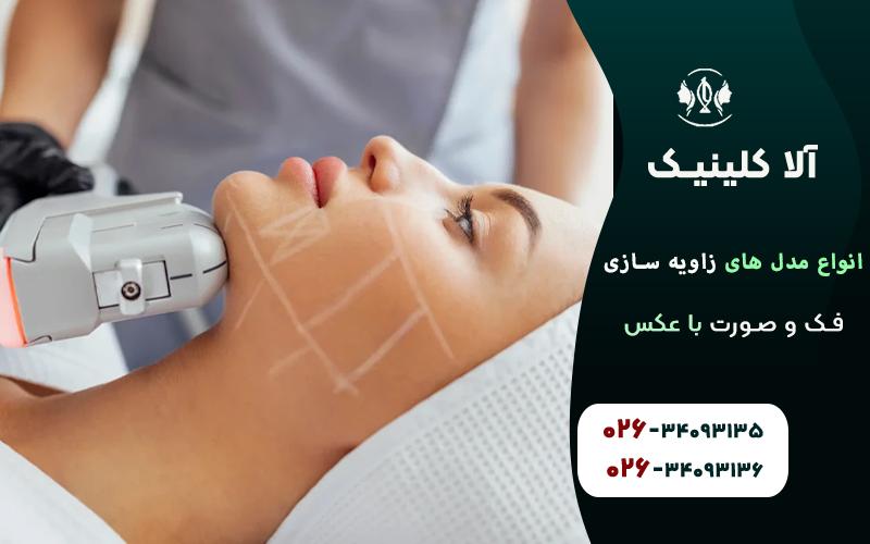 انواع مدل های زاویه سازی فک و صورت