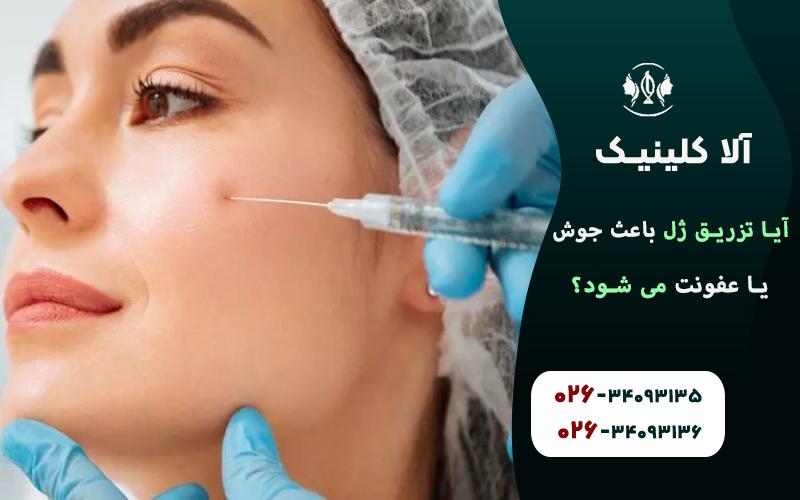 آیا تزریق ژل باعث جوش یا عفونت می شود!