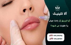 آیا تزریق ژل باعث جوش یا عفونت می شود!