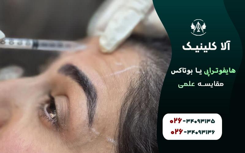 هایفوتراپی خوبه یا بوتاکس (مقایسه علمی)