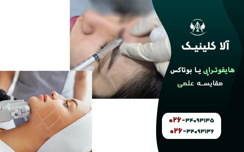 هایفوتراپی خوبه یا بوتاکس (مقایسه علمی)