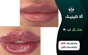 مدل ژل لب M