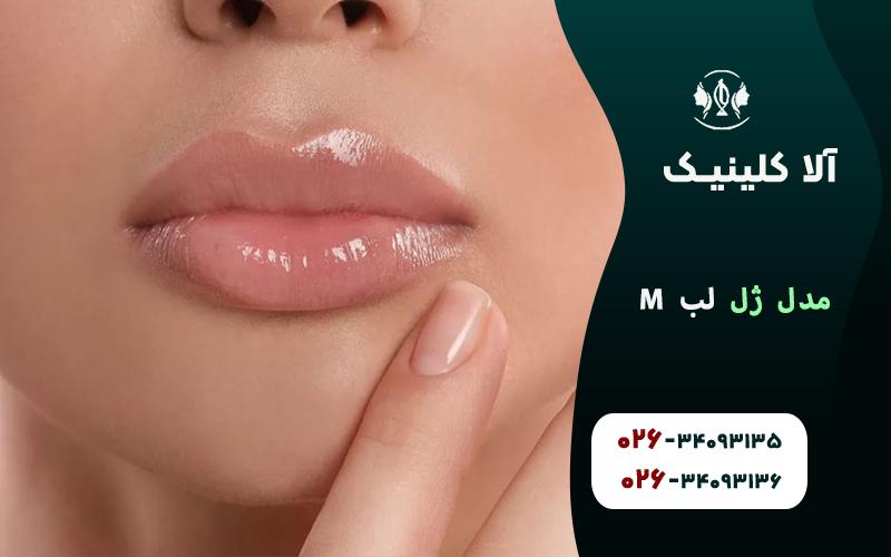 مدل ژل لب M
