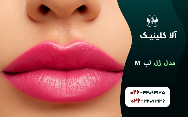 ژل لب M
