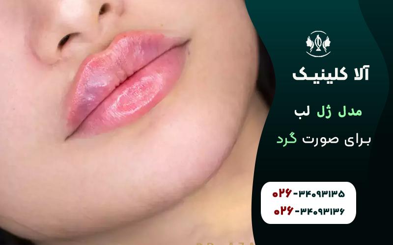 مدل ژل لب برای صورت گرد