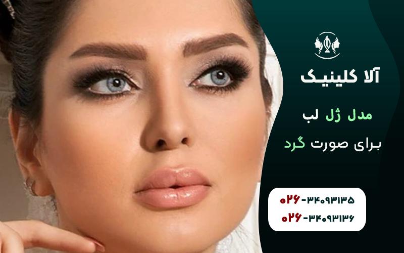 مدل مناسب ژل لب برای صورت گرد