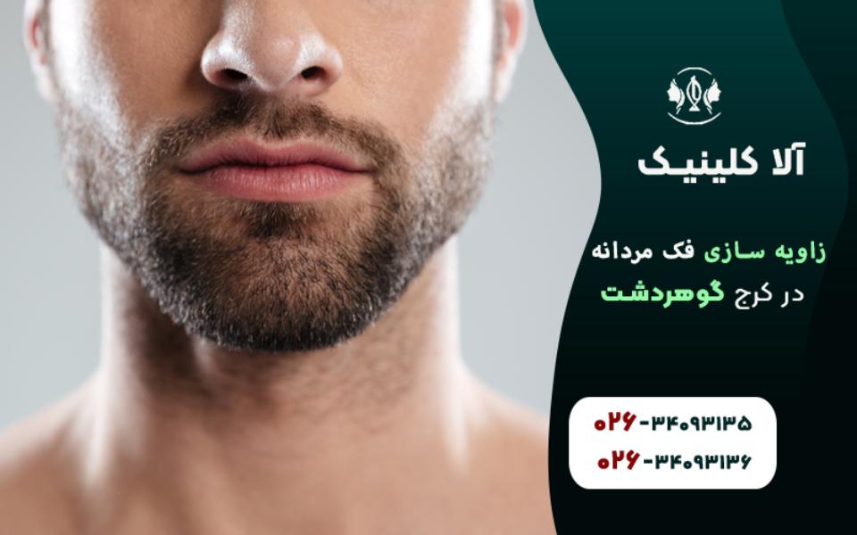 زاویه سازی فک مردانه در کرج