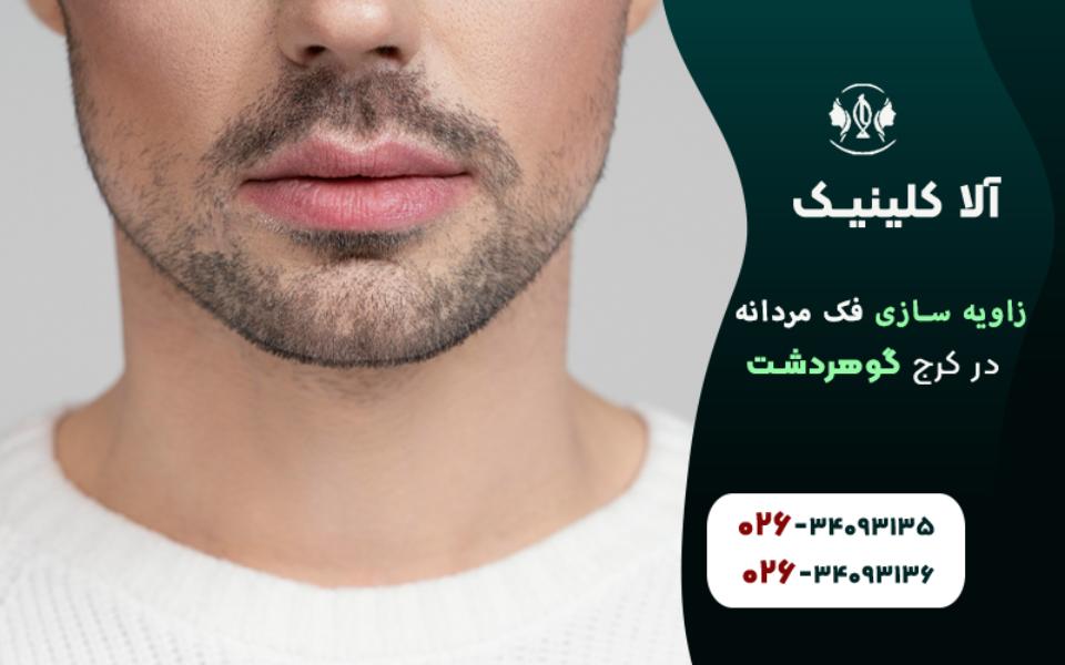 زاویه سازی فک مردانه در کرج