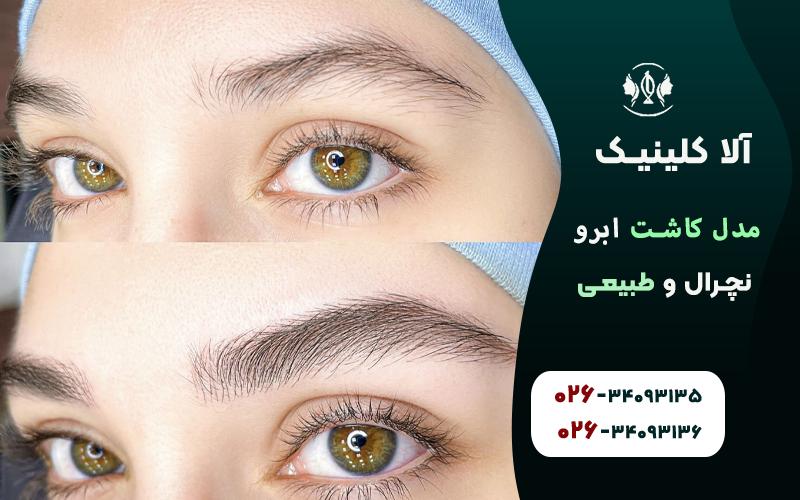 مدل کاشت ابرو نچرال و طبیعی