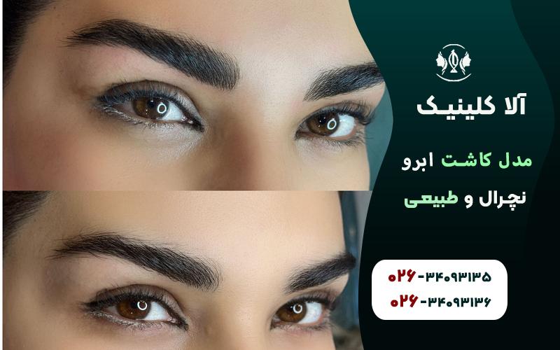 مدل کاشت ابرو نچرال و طبیعی