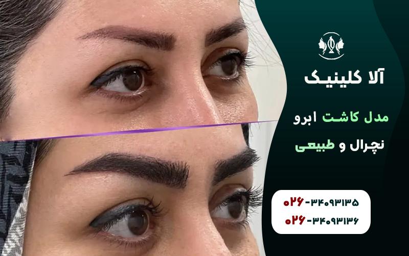 مدل کاشت ابرو نچرال و طبیعی