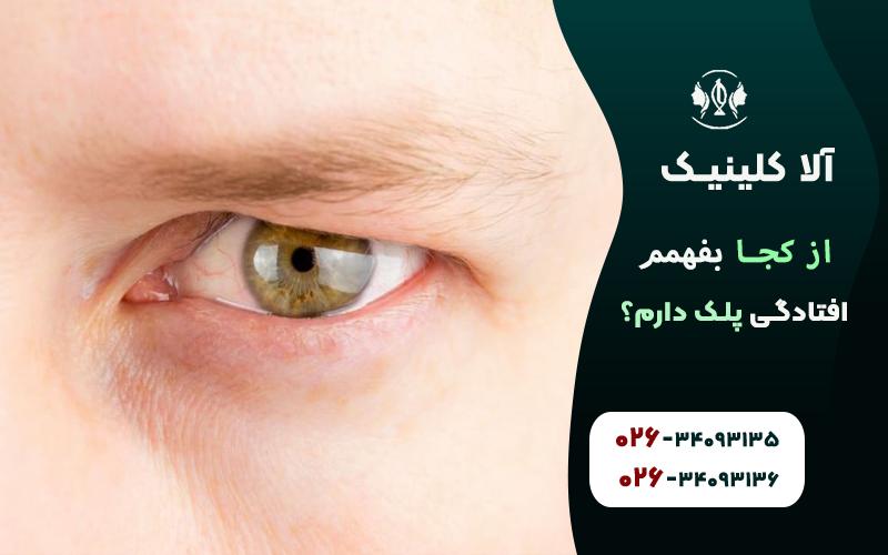 برای تشخیص قطعی، پزشک با اندازهگیری فاصله بین مردمک و لبهی پلک (MRD1) مشخص میکند که آیا افتادگی