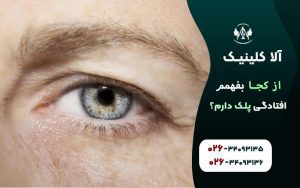 از کجا بفهمم افتادگی پلک دارم