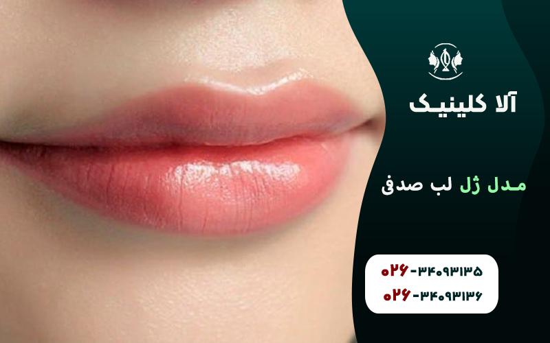 مدل ژل لب صدفی