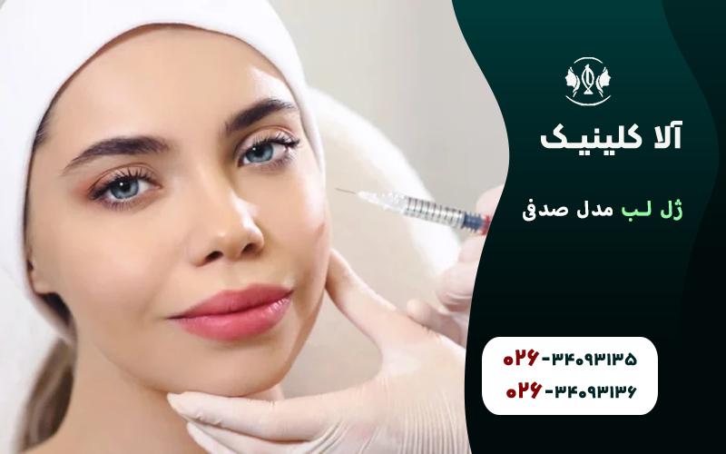 تزریق ژل لب مدل صدفی