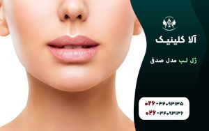 مدل ژل لب صدفی