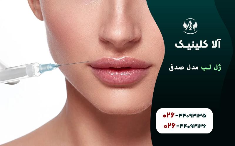 مدل ژل لب صدفی