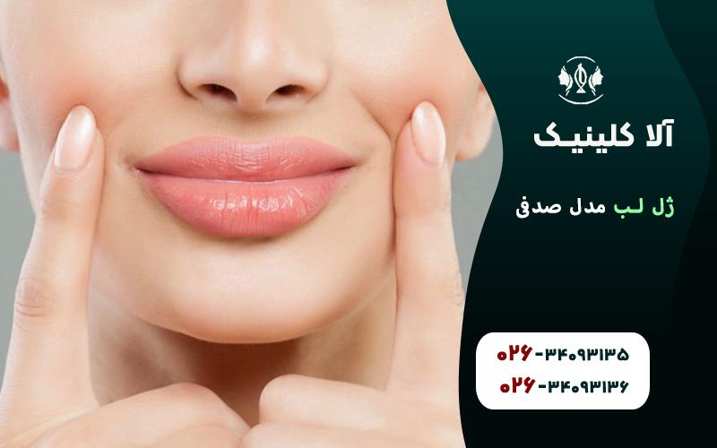 مدل ژل لب صدفی