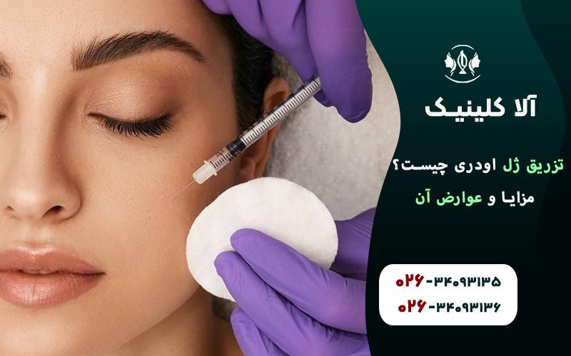 تزریق ژل اودری چیست؟ مزایا و عوارض آن