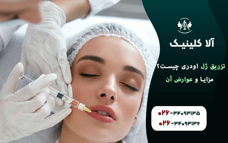 تزریق ژل اودری چیست؟ مزایا و عوارض آن