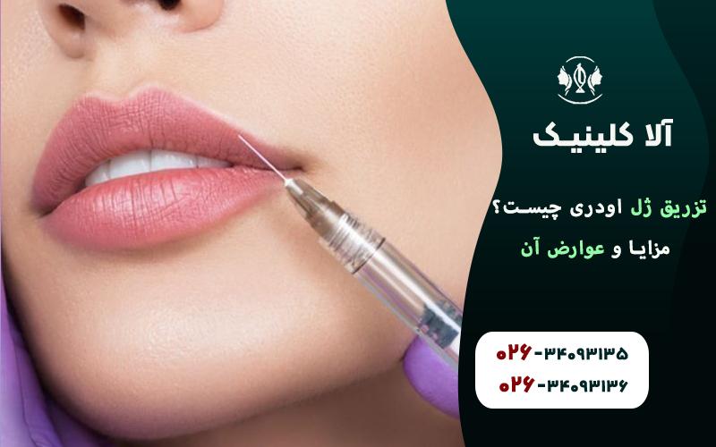 تزریق ژل اودری چیست؟ مزایا و عوارض آن
