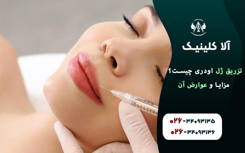 تزریق ژل اودری چیست؟ مزایا و عوارض آن