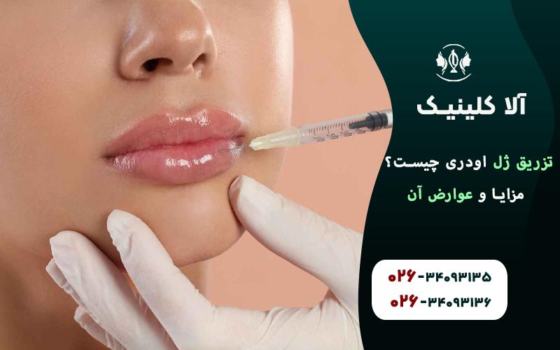 تزریق ژل اودری چیست؟ مزایا و عوارض آن