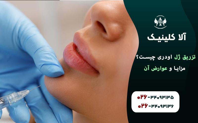 تزریق ژل اودری چیست؟ مزایا و عوارض آن