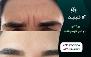 بوتاکس فلکه اول گوهردشت کرج